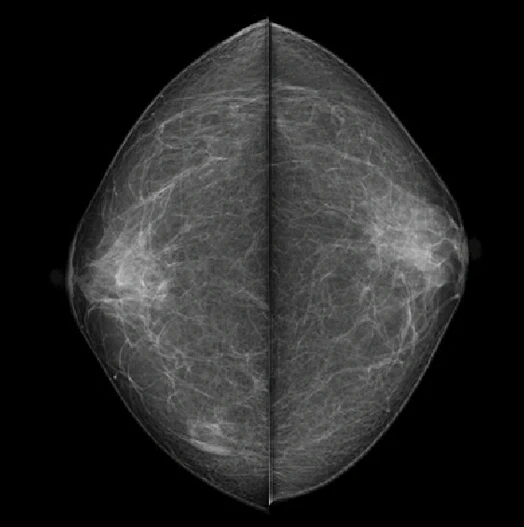 MX-600 · Clinical images 3